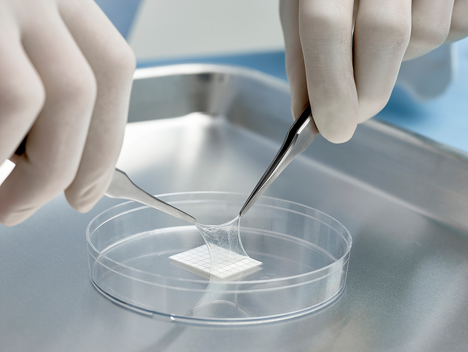 AmnioGraft_prep_51070_v1